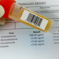 ¿Se puede dar positivo en los test de drogas por usar productos CBD legales?
