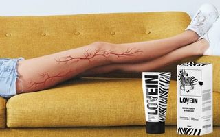 Lovein Cream Review: Say Goodbye to Varicose Veins (India)