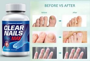Comprehensive Benefits of Clear Nails Max